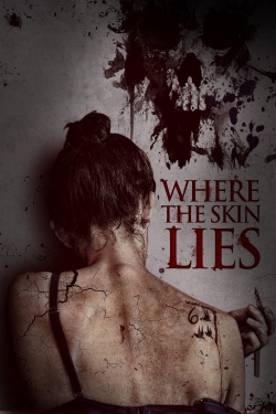 watch free Where the Skin Lies hd online